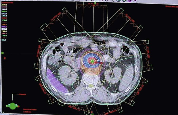 <p><span>Identify the modality/capability best represented by this image:</span></p>