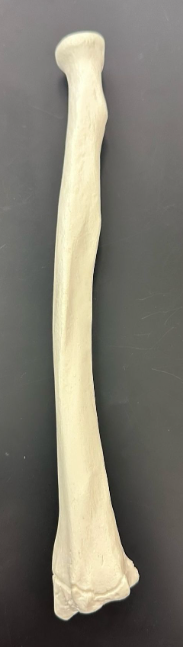 <p>What is this bone?</p>