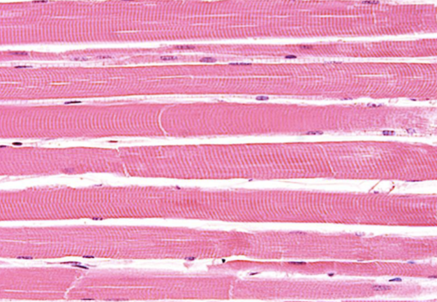 <p><span style="font-size: calc(var(--scale-factor)*11.00px)">Indique tipo de tejido muscular</span></p>