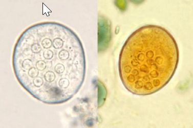 Quiste de Entamoeba coli