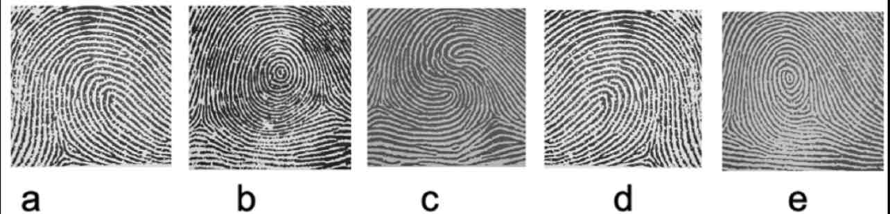 <p>Which one is the ulnar loop-left hand?</p>