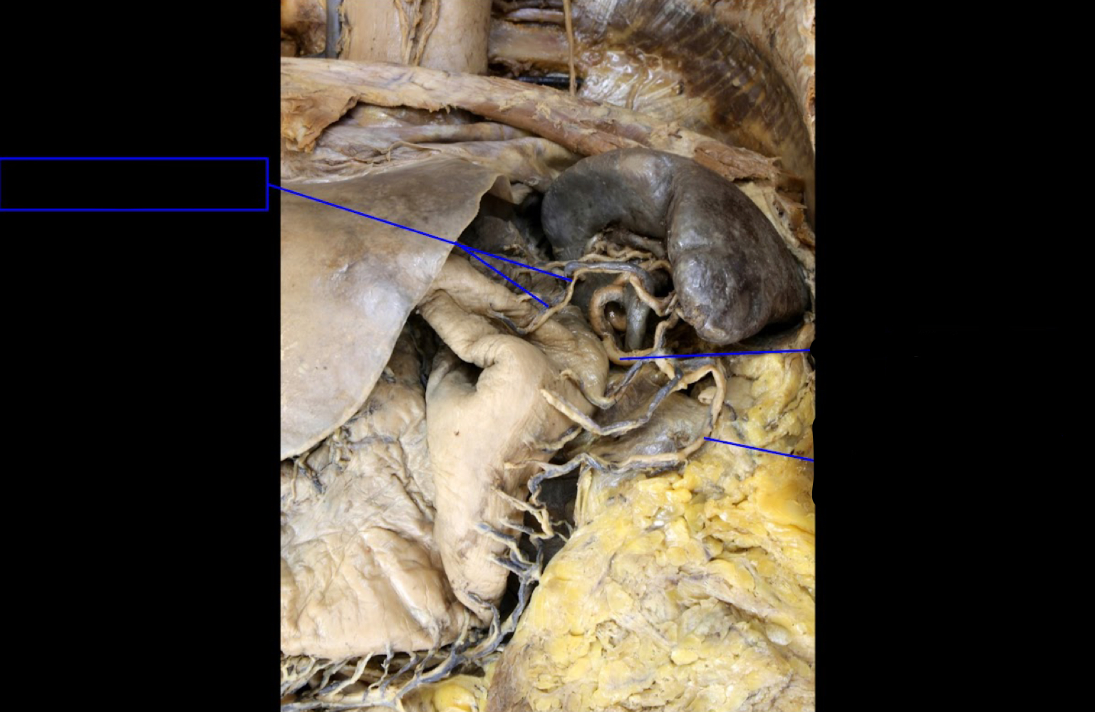 <p>A). Identify this structure<br>B). Which structure is this from?<br>C). What does it supply?</p>