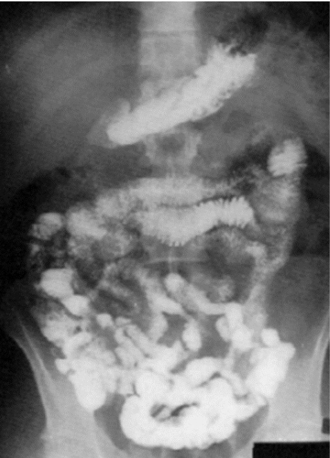<p><span>What contrast procedure was performed to produce this image?</span><br></p>