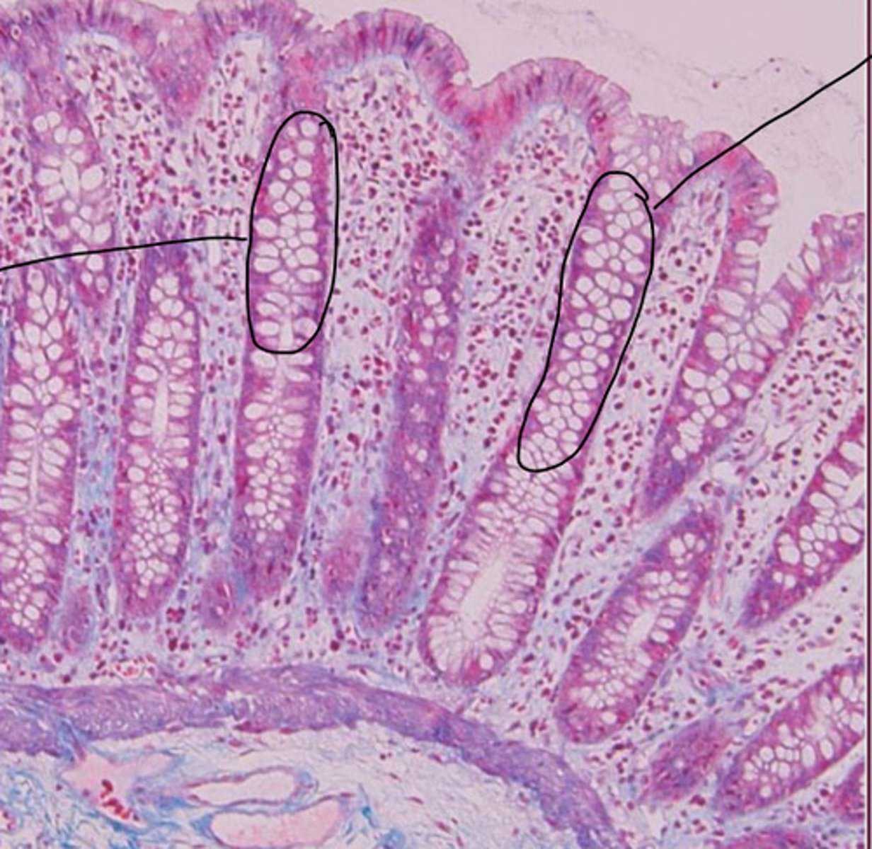 <p>ID the Histology</p>
