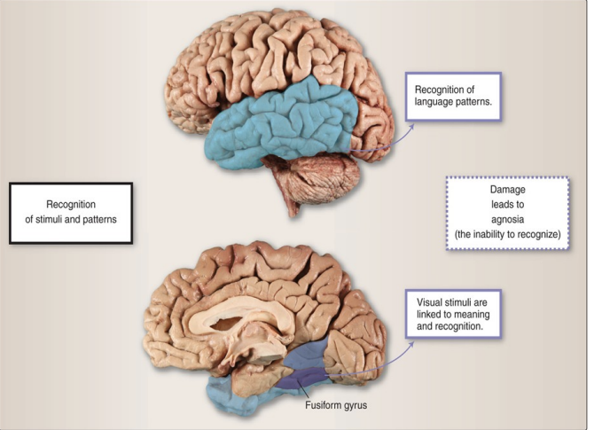 <p>Structure located in the medial temporal lobe</p><p> In cross section resembles a ‘sea horse’ </p><p>Short term storage of new learning. </p><p>Critical for long-term memory storage. </p><p>Declarative(Explicit)memory</p>