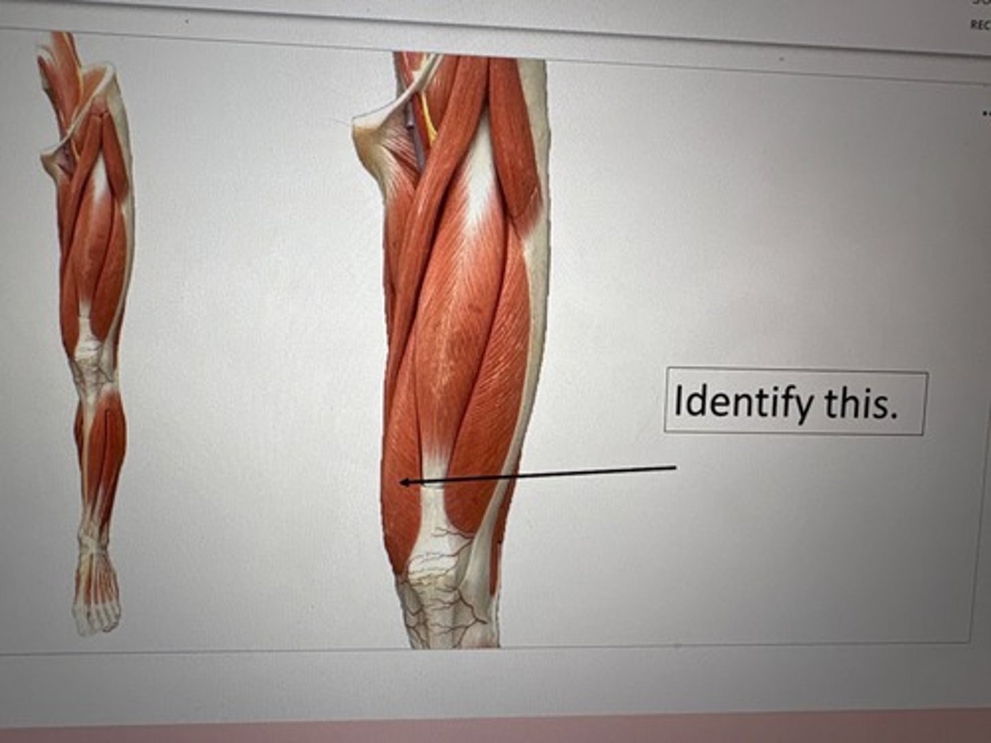 term image