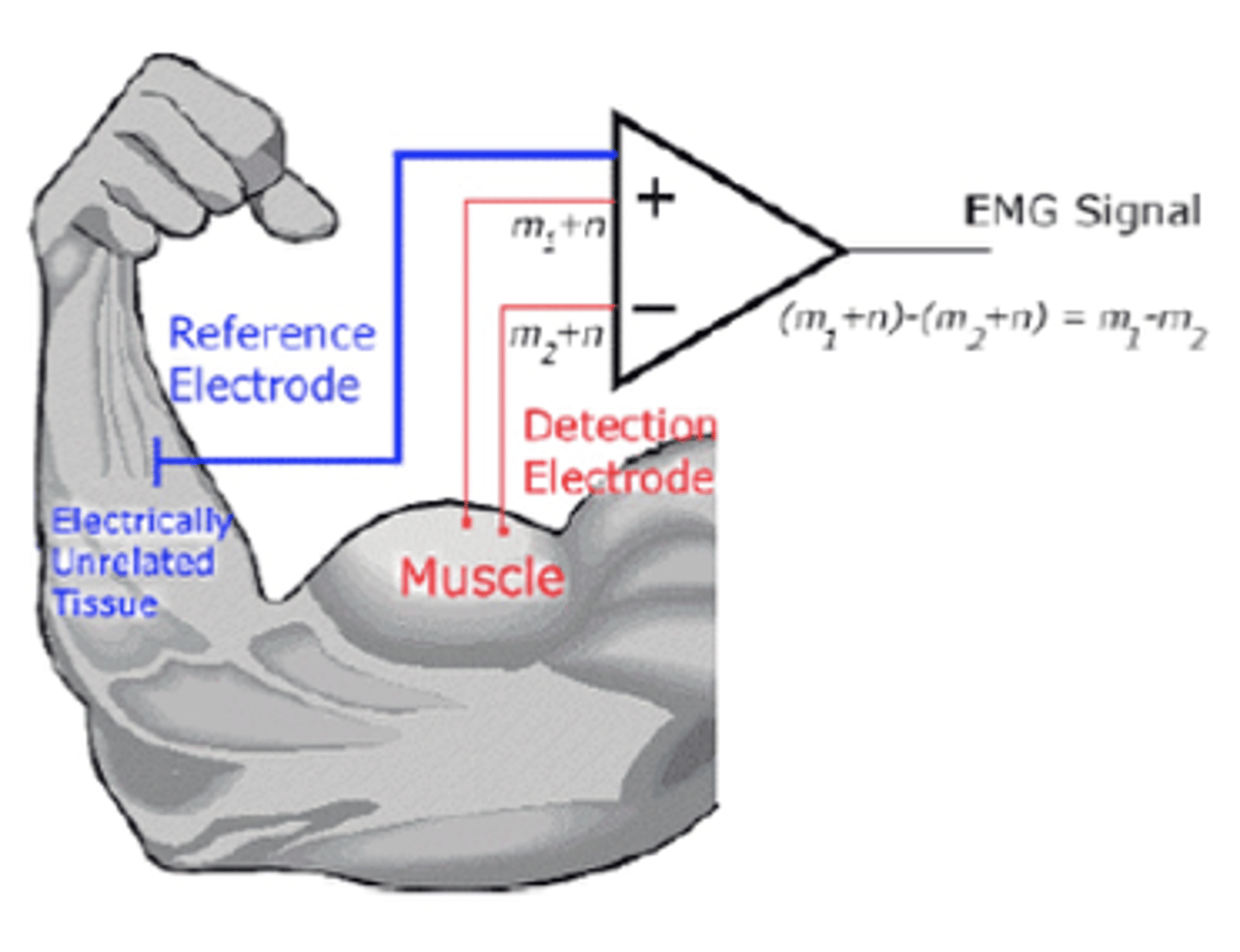<p>bipolar</p><p>2 electrodes</p><p>common signal is attenuated*</p>