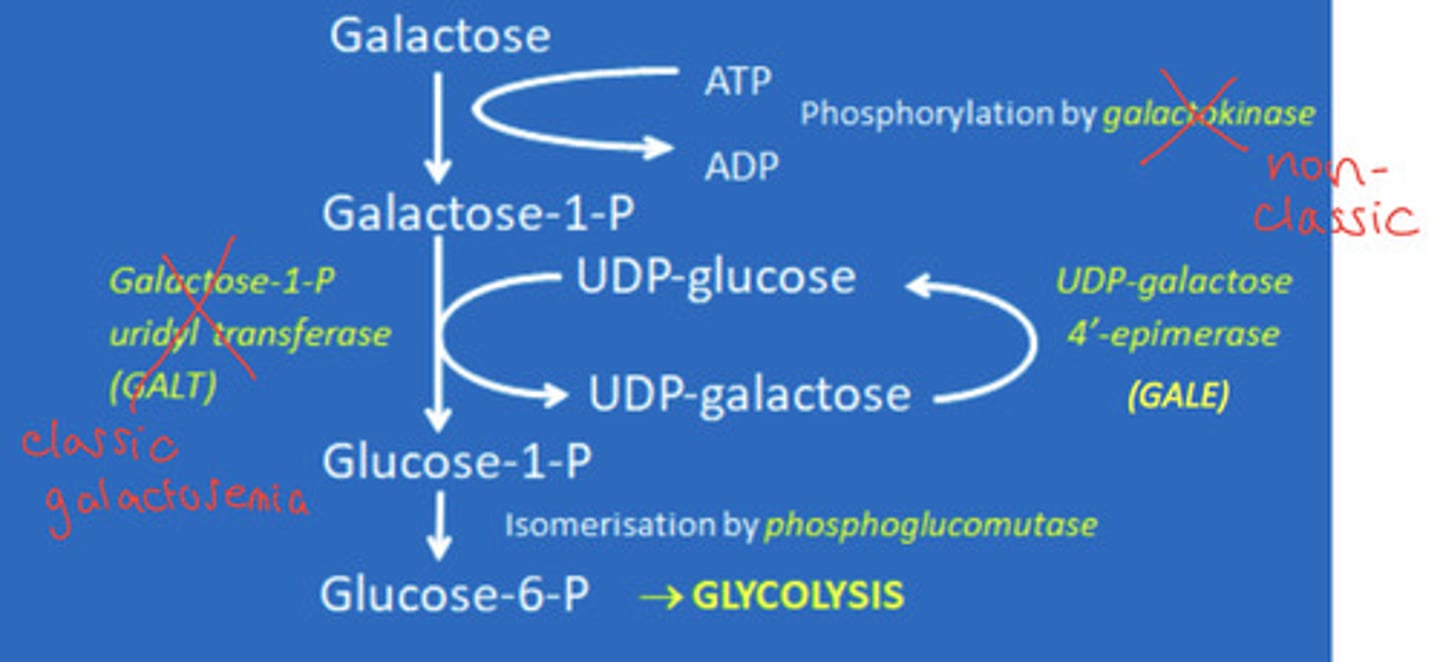 <p>- Galactose-1-phosphate uridyl transferase (GALT) deficiency - Leading to accumulation of galactose-1-p and galactitol</p>
