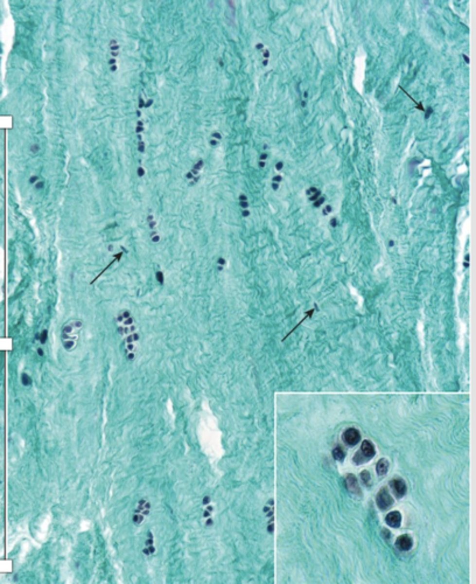 <p>What do fibrocartilage chondrocytes synthesize?</p>