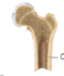 <p>provides great strength and support, forms a solid outer shell on bones that keeps them from being easily broken or punctured; in the outer portions of all bones, the shafts of long bones</p>