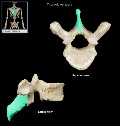 <p>Single medial and posterior projection from the vertebral arch</p>