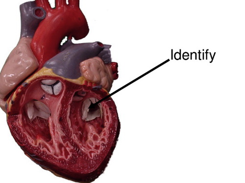 <p>Prevents back-flow of blood into left atrium during ventricular systole; also called the mitral valve</p>