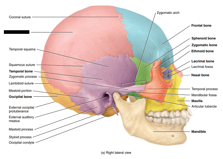 <p>State and identify what part of the cranial bone is being pointed out and censored. </p>