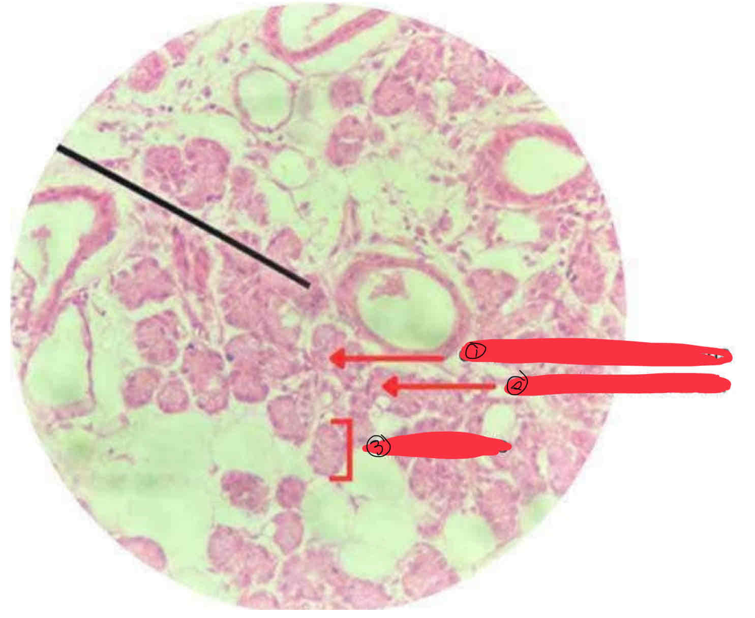 <p>parotid gland</p>