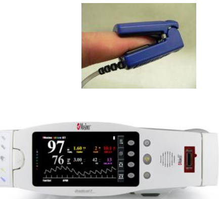 <p>part of – in vivo spectrophotometry</p><p>Measures the oxygen saturation of a patient's blood</p>