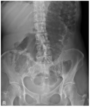 <p>What is this and what type of scan </p>