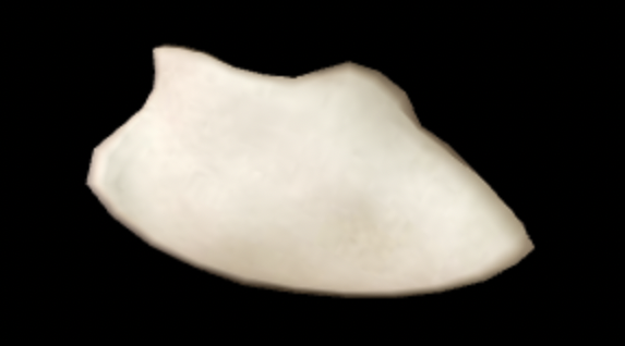 <p>Which bone is this?</p>