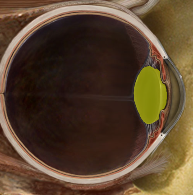 term image