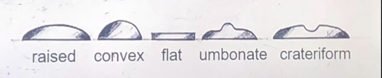 <p><span><strong><span>______________</span></strong><span> (shape viewed from the </span><u><span>side</span></u><span> of the colony)</span></span></p>