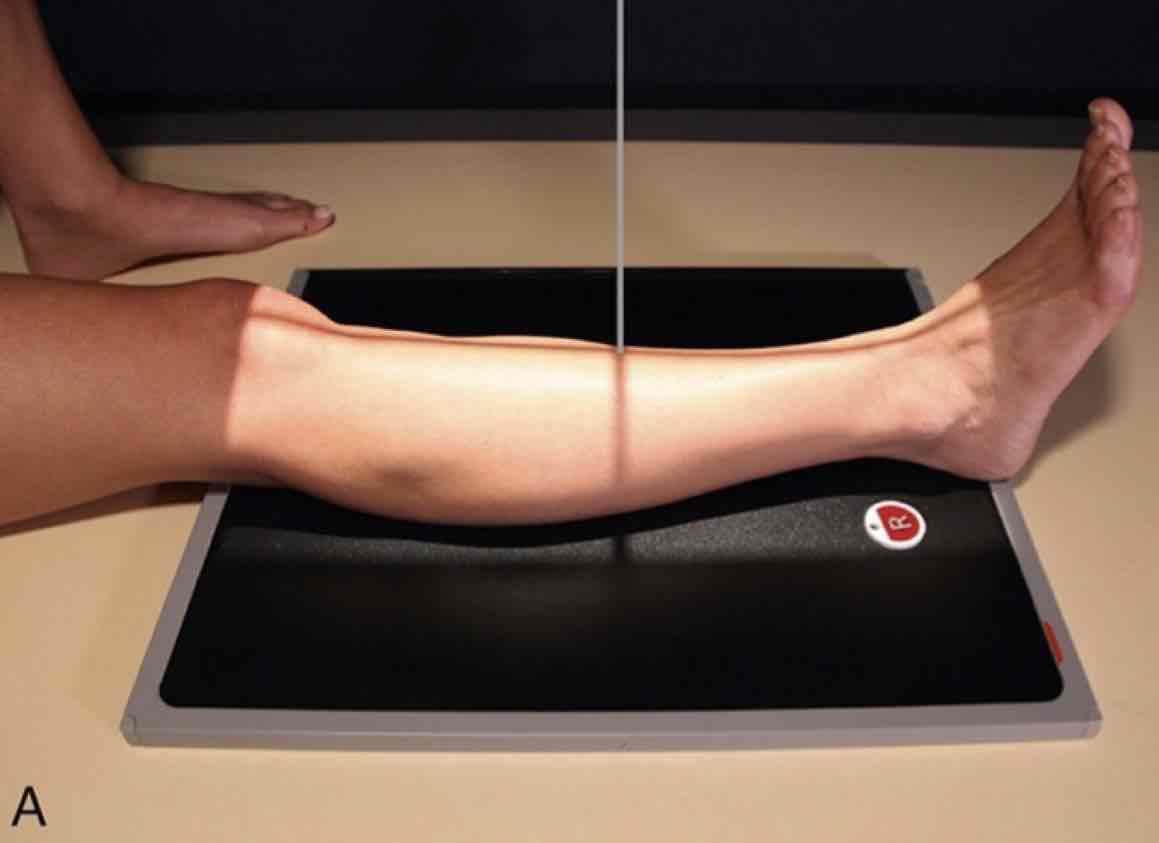 <p>What Projection is this?</p>