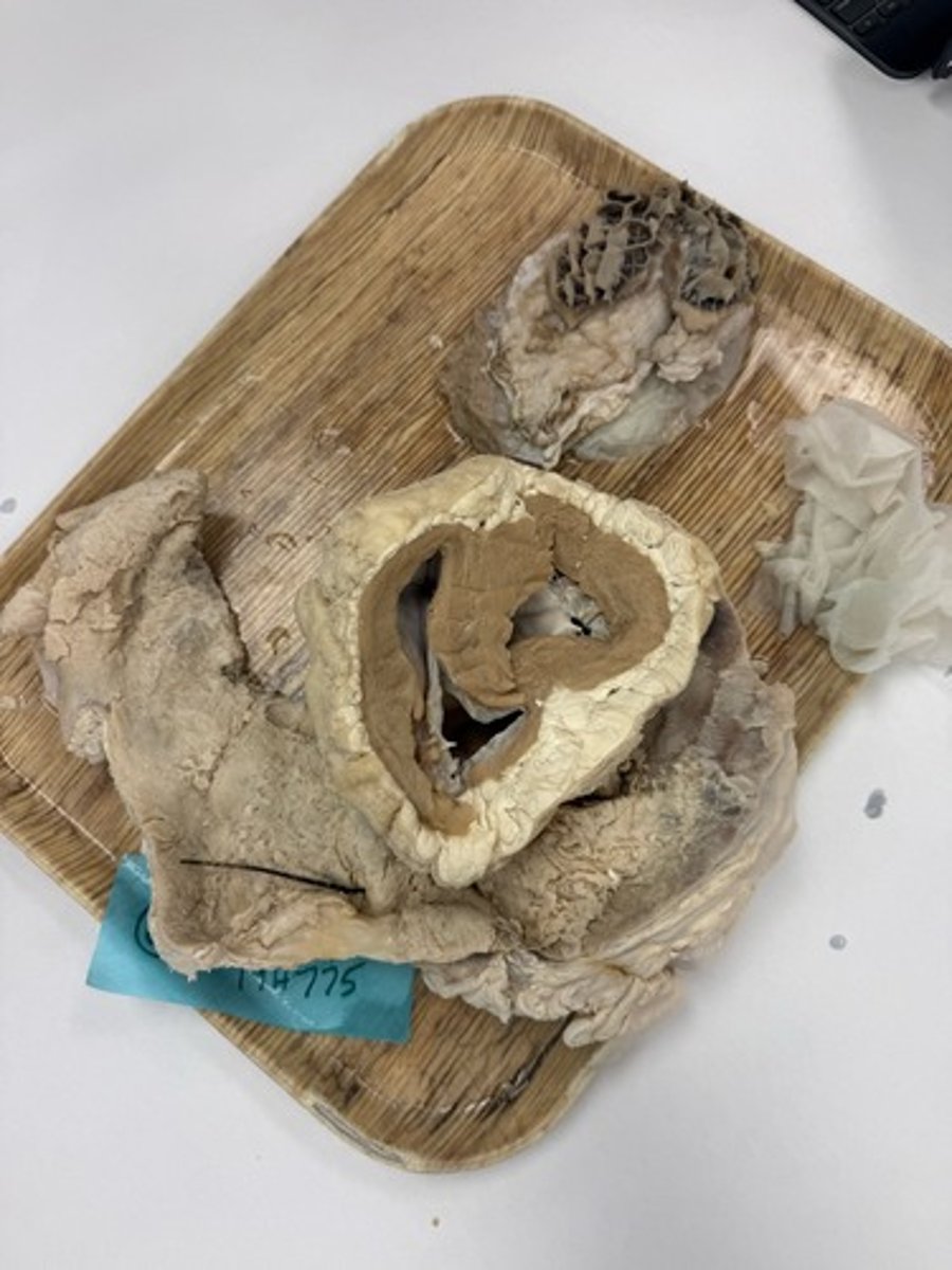 <p>Provide morphological diagnosis</p>