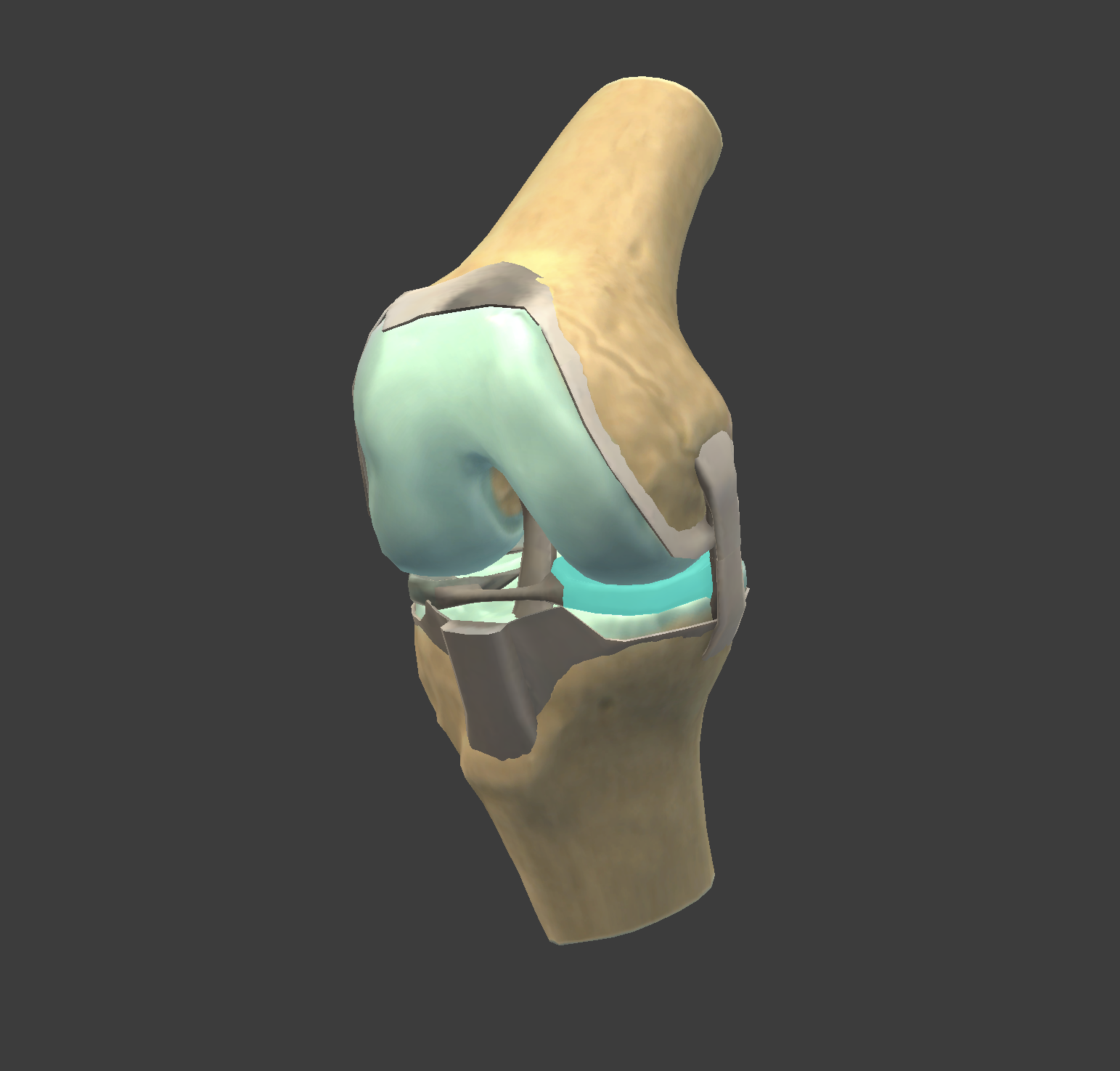 <p>A C-shaped cartilage in the knee that provides cushioning and stability between the femur and tibia. (teal part)</p>