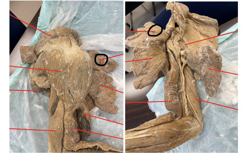 <p>what muscle do the marked images represent?</p>