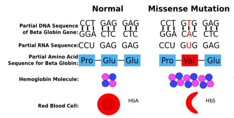 <ol><li><p>HBB (HbA → HbS)</p></li><li><p>p.Glu6Val (non-conservative)</p></li></ol><p></p>