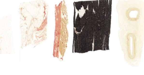 <p><span>It intensely stains </span><strong>elastic fibers</strong><span> black and lightly stains </span><strong>collagen</strong><span> red.</span></p>