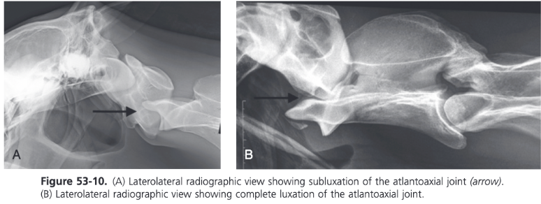 <ul><li><p><span>Subluxation of the atlantoaxial articulation without fracture of the dens is a rare condition seen in young horses up to 3 years of age</span></p></li><li><p><span>Can be congenital or traumatic in origin</span></p></li><li><p><span>Complete luxation of the atlantoaxial articulation resulting in displacement of the dens so that it lies ventral to the atlas is very rare</span></p></li><li><p><span>For luxation to develop there needs to be complete disruption of the ligamentous attachments of the dens</span></p></li><li><p><span>Atlantoaxial instability produces clinical signs in older foals and young horses</span></p></li><li><p><span>Subluxation of the atlas relative to the axis occurs during extension of the head and neck because of malalignment of the atlas, resulting in caudal ventral tilting of the atlas relative to the vertebral canal</span></p></li><li><p><span>Neurologic signs can be acute or chronic and can vary in severity from mild ataxia to recumbency</span></p></li><li><p><span>When the neck is extended further, evidence of subluxation on radiographs includes lengthening of the space between the articular surfaces of the atlas and the axis ventrally and shortening of the space between the dorsal arch of the atlas and the spinous process of the axis</span></p></li></ul>