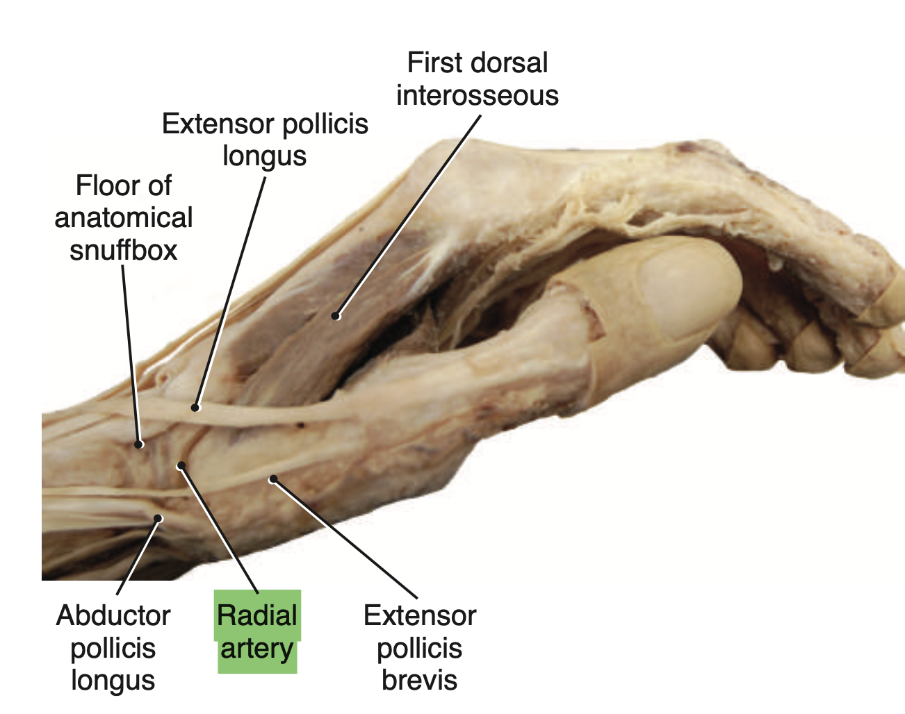 <p>Radial artery</p>