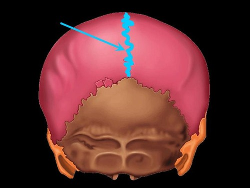 between the 2 parietal bones 

\
