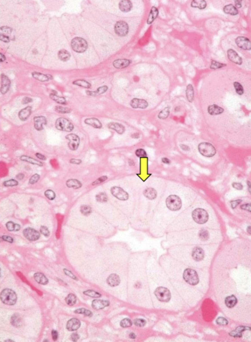 <p>What type of epithelium is shown?</p>