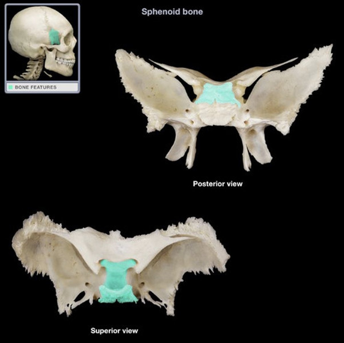 <p>sphenoid bone</p>