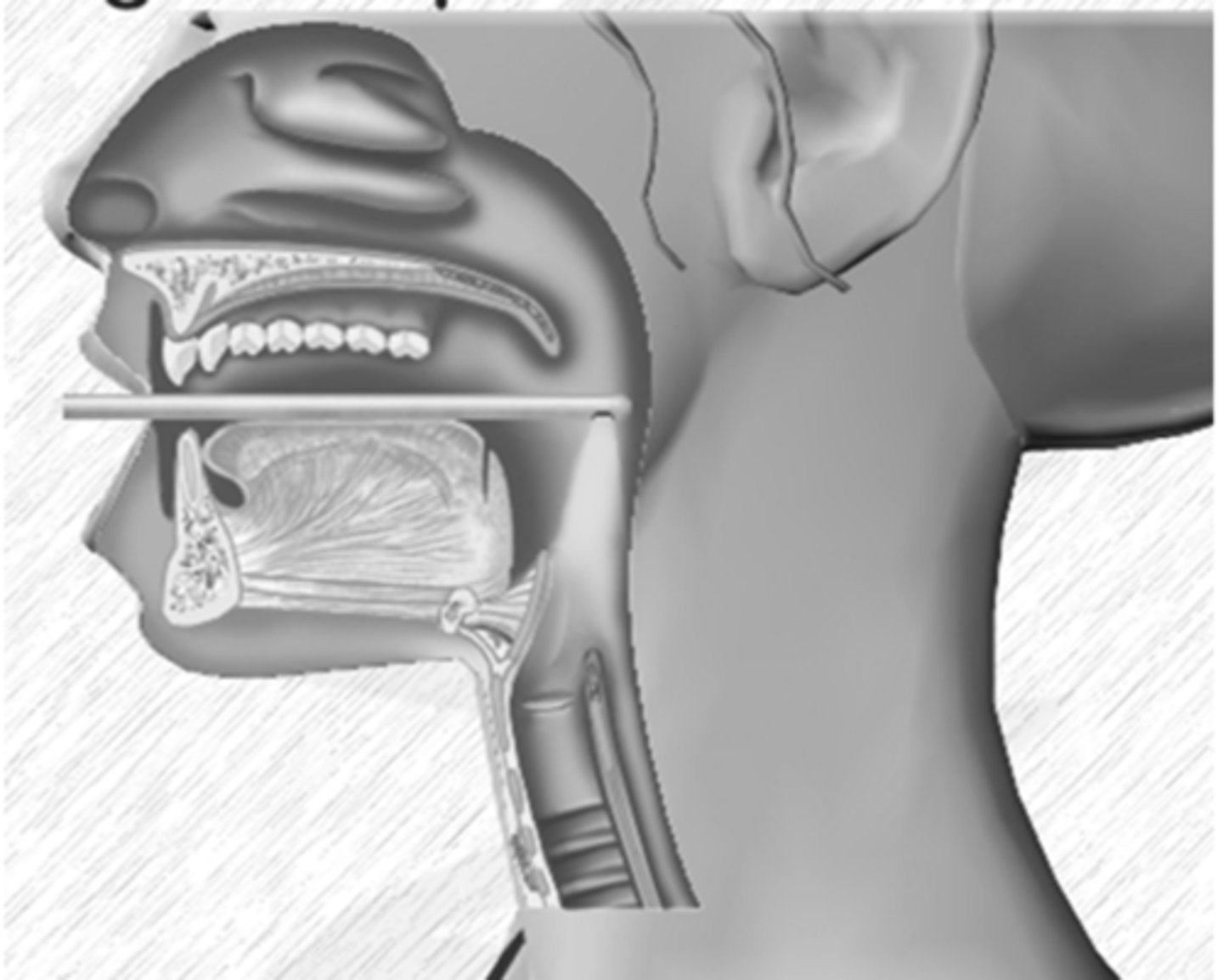 <p>this type of laryngeal endoscope creates larger, more stable, brighter images, works only a sustained vowel. Client posture is unnatural. Ideal for close views of the VF or lesion, patients who can tolerate it, and when VF vibration patterns are important to observe when strobe light is used</p>