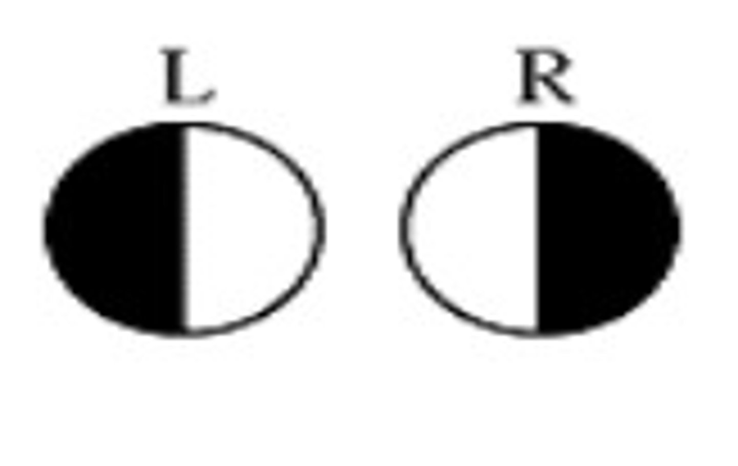 <p>lateral visual field loss </p>