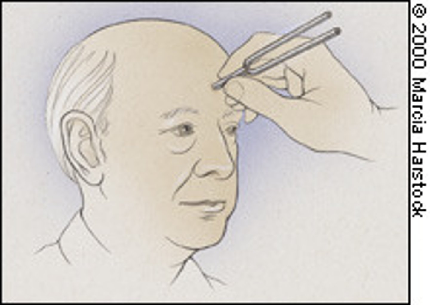 <p>vibrating tuning fork on forehead</p>
