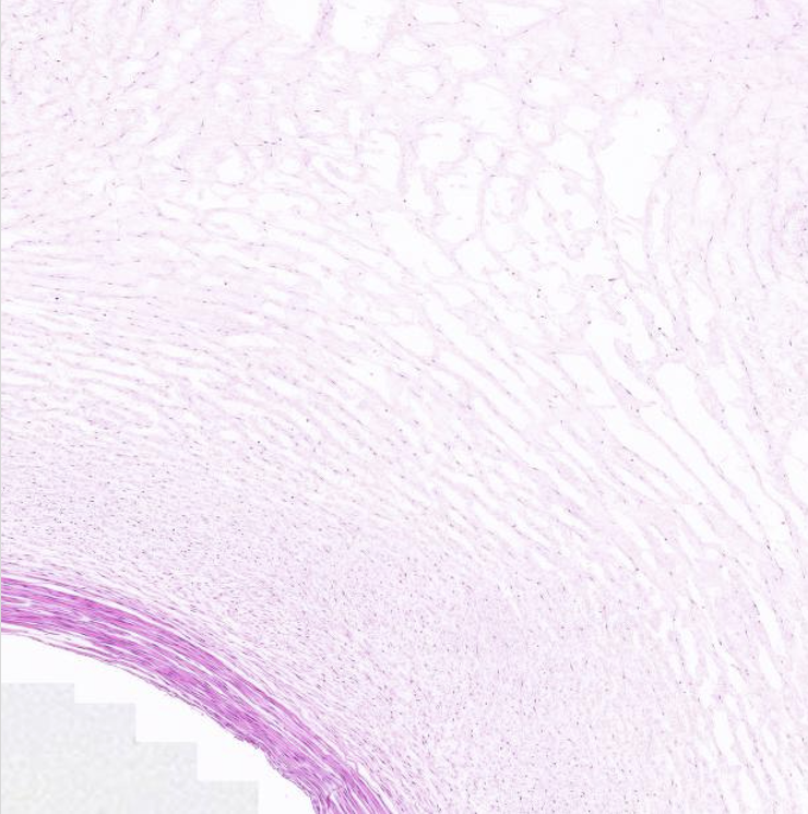 <p>What type of tissue is shown here?</p>