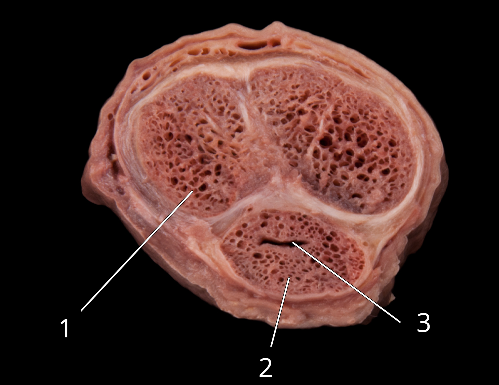 <p>Penis, transverse section </p>