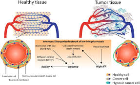 <p>Pericytes surround endothelial can be sparsely distributed</p><p>Leaky vessels increase oxygen and nutrient supply for cancer cells.</p>