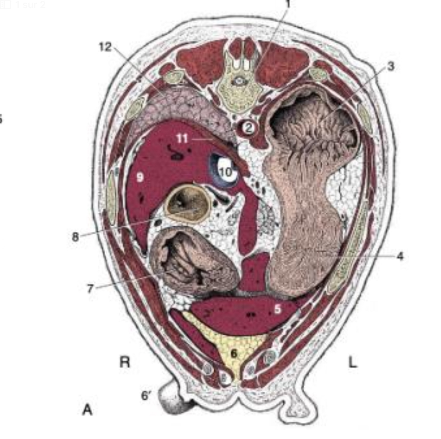 term image