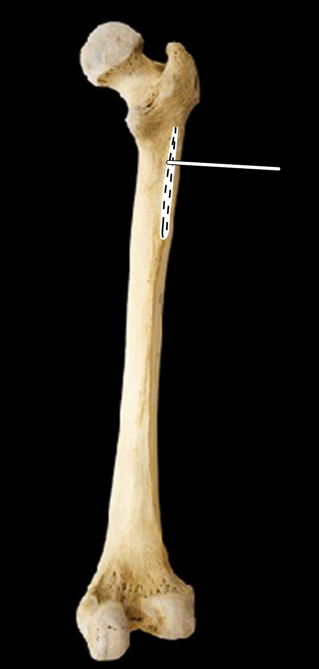 <p>Name the highlighted portion.</p><p>(Femur, posterior view, right side).</p>