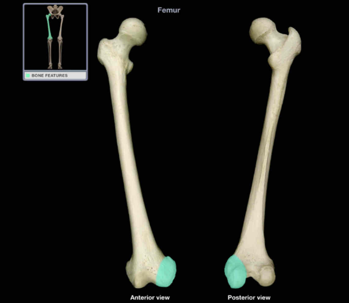 <p>Medial condyle of femur</p>