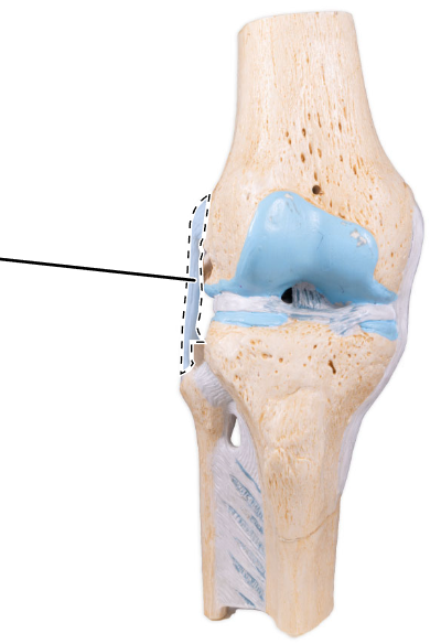 <p>What ligament is shown here?</p>