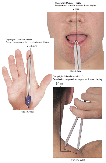 <ul><li><p>Distributed throughout dermal papillae</p></li><li><p>Involved in two-point disccrimination</p><ul><li><p>ability to detect simultaneous stimulation of Meissner corpuscles in two distinct receptor fields by touching at two points on the skin</p></li><li><p>distance between two points varies in different body regions (abundant in tongue and finger tips, less in back)</p></li></ul></li><li><p>Evaluates texture of objects </p></li></ul><p></p>