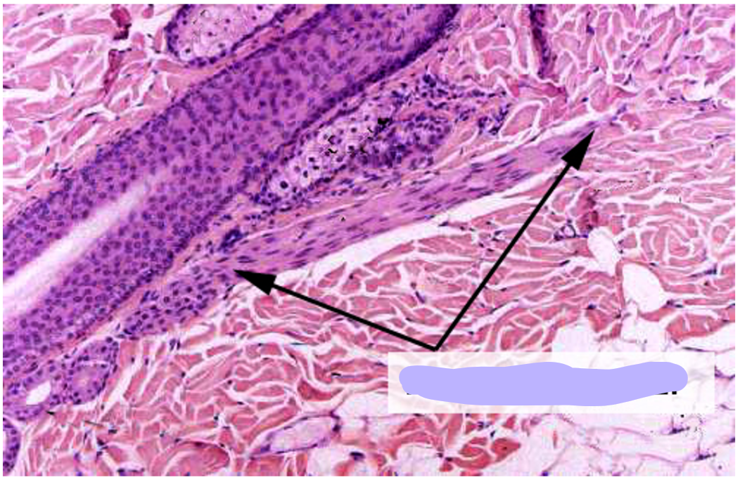 <p>the arrows point to&nbsp;</p>