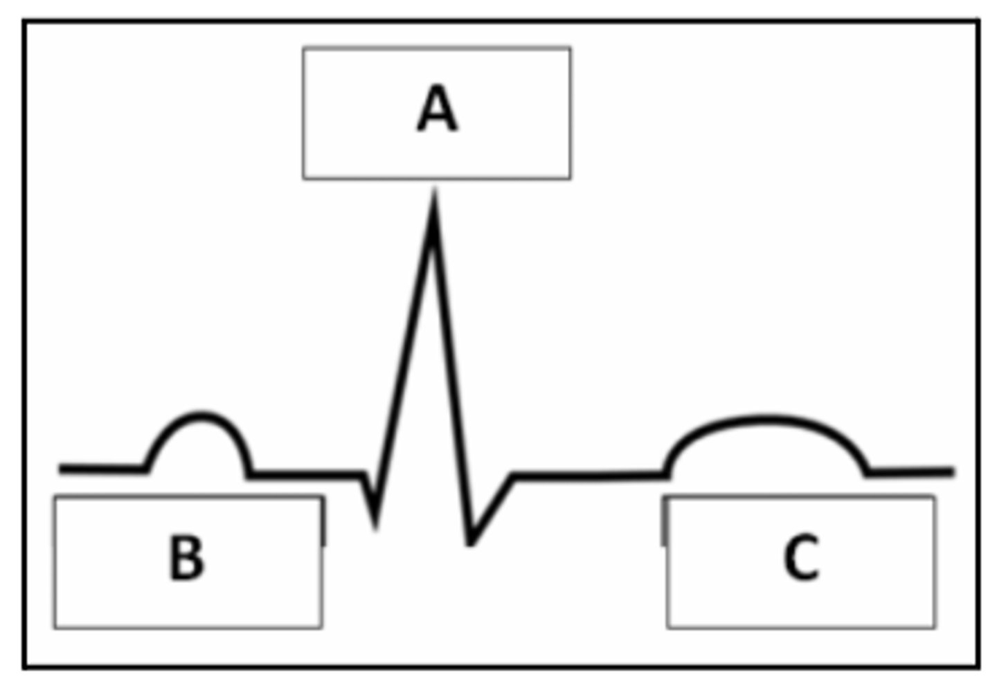<p>Match the parts of an EKG/ECG to the correct description.</p><p>1. P wave</p><p>2. QRS complex</p><p>3. T wave</p><p>4. Ventricular depolarization</p><p>5. Ventricular repolarization</p><p>6. Atrial depolarization</p><p>7. Atrial repolarization</p><p>A</p><p>B</p><p>C</p><p>Masked by the QRS complex</p>