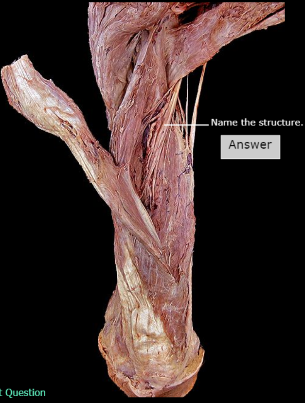 <p>What nerve is this</p>