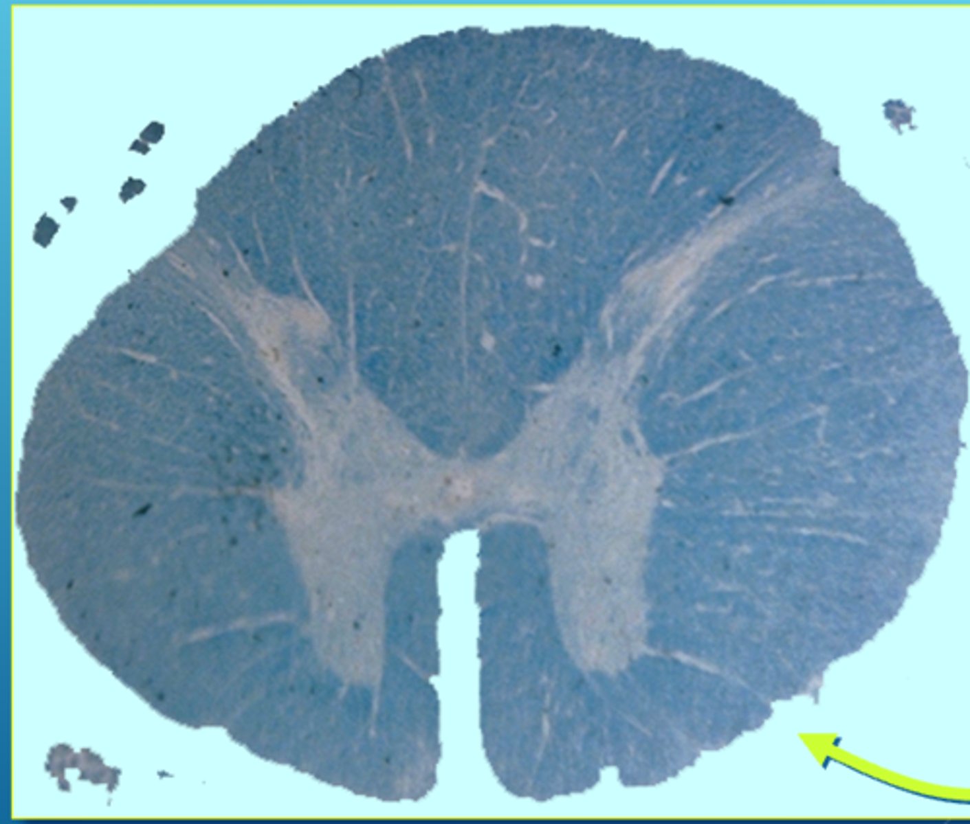 <p>Ventral root exit here</p>