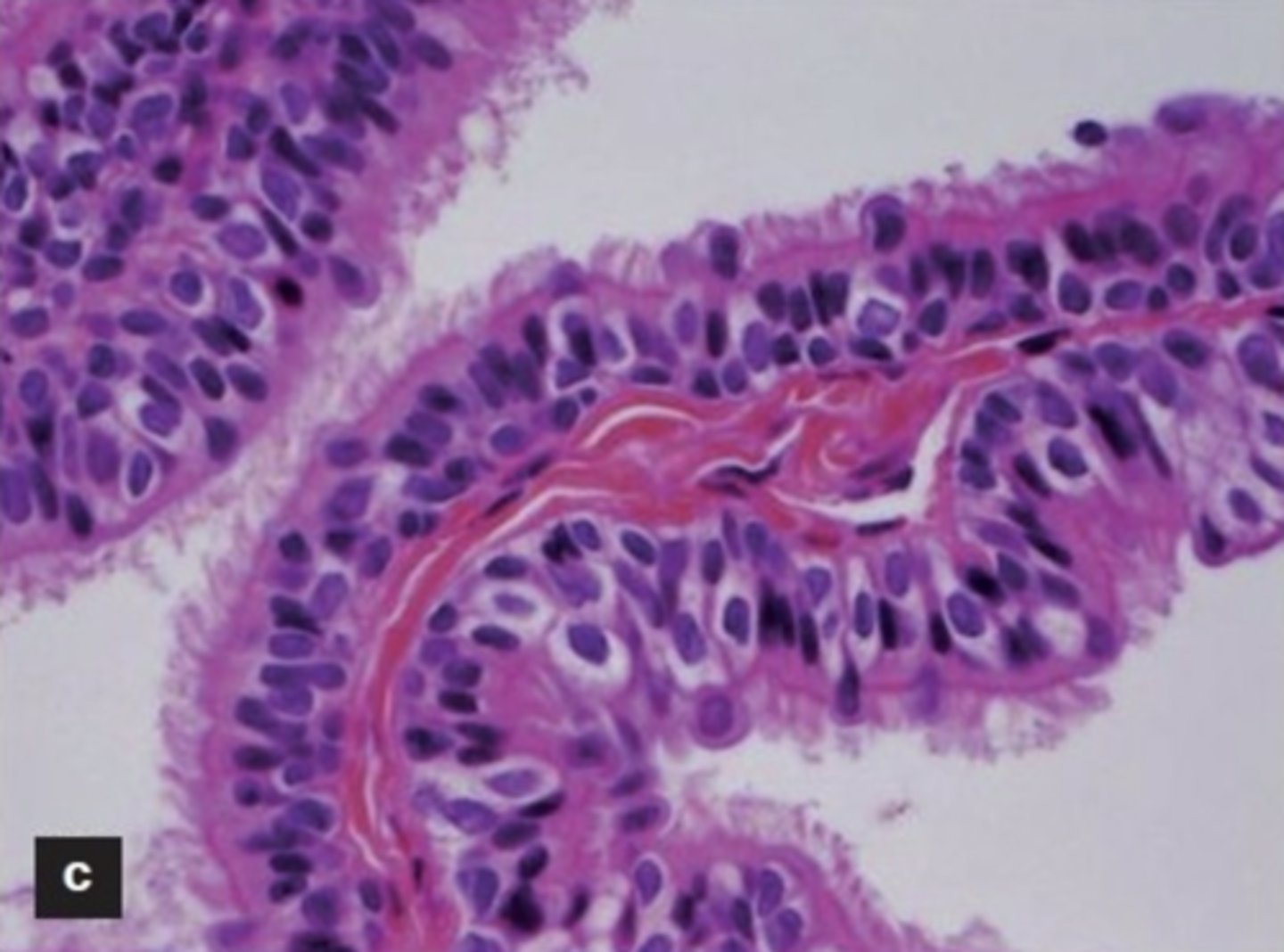 <p>- columnar or cuboidal</p><p>- pseudostratified columnar</p>